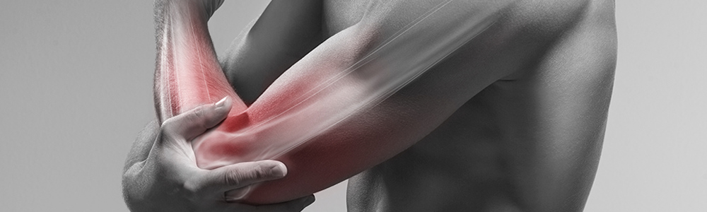 이미지명